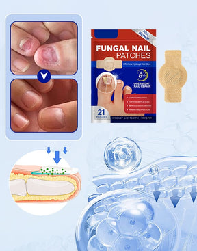 FungiCare – Advanced Nail Repair Patches