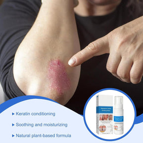 DermaCalm – Magnesium Botanical Spray