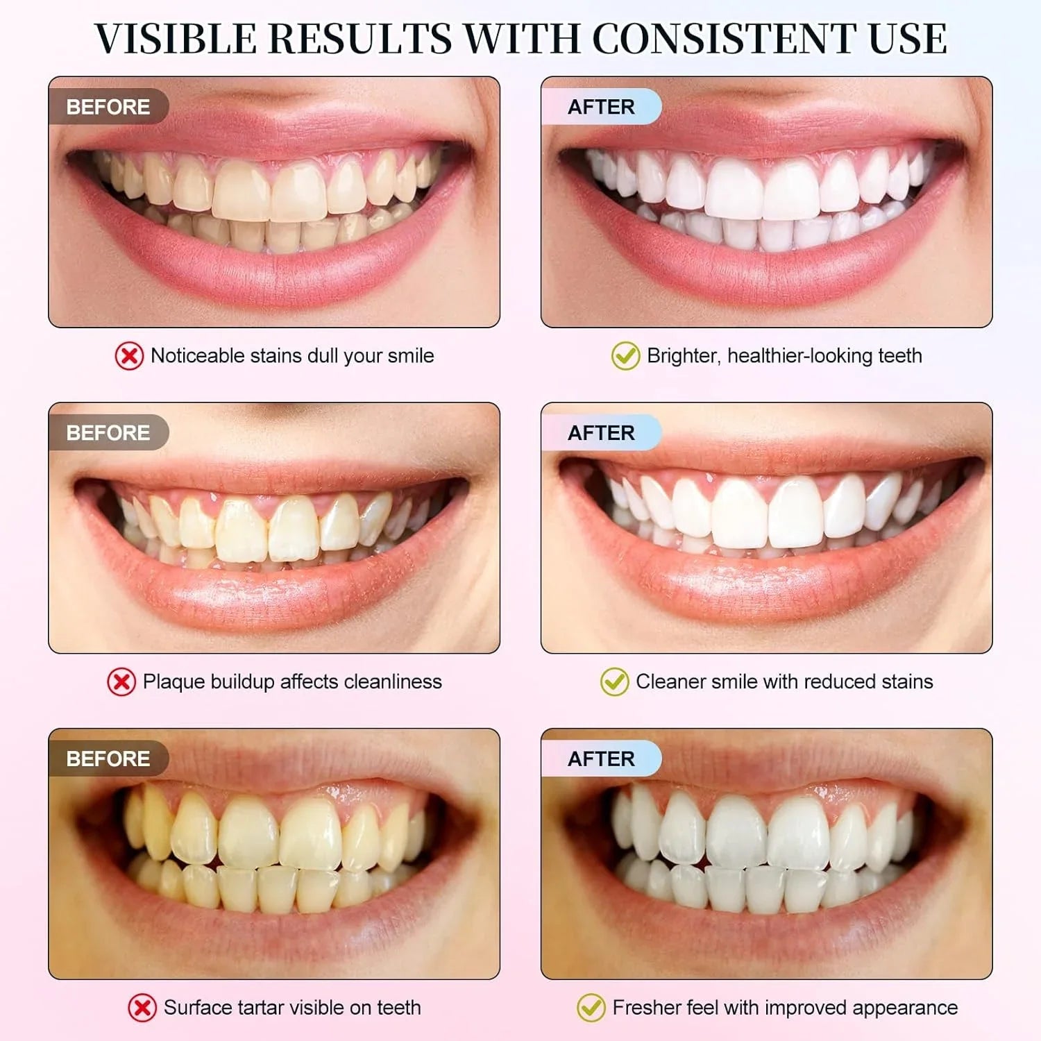 Niacinamide Whitening Toothpaste – Stain Removal & Fresh Breath