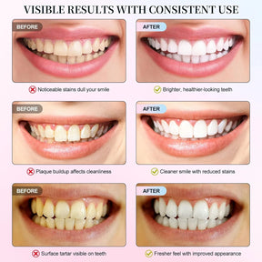 Niacinamide Whitening Toothpaste – Stain Removal & Fresh Breath