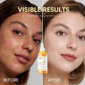 PureGlow – Kojic Acid Herbal Brightening Serum