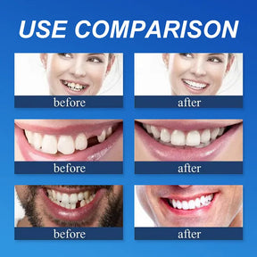 🌎Ends Today: 70% OFF! ⏰Yagoo™ Medical Full Denture with Strong Suctiond🦷Obtain American Dental Association (ADA) Certification