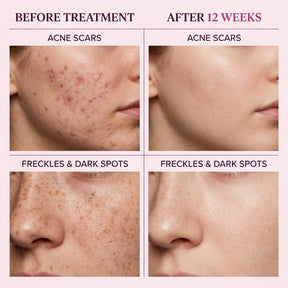 Evenova – Radiance & Tone Balance Cream