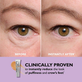 BlinkRevive – Instant Eye Tightening Solution
