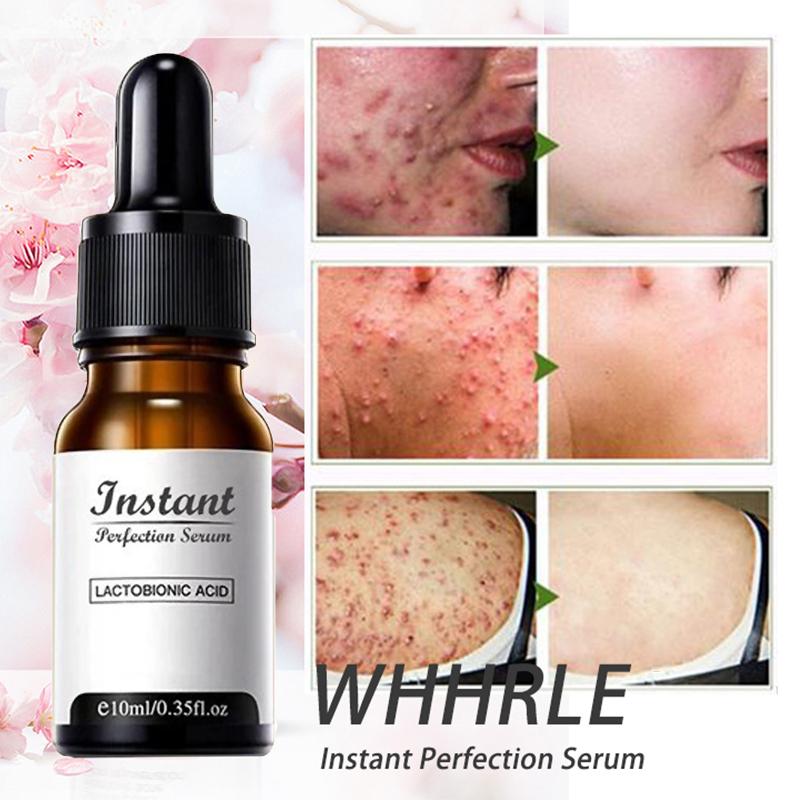 DermaYouth – Argireline Anti-Aging Formula