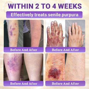 DermaVive – Biotin 10-in-1 Skin Restoration Cream