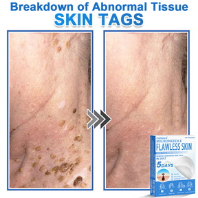 GlowSkin -  2-in-1 Microneedle & Hydrocolloid Star Patch