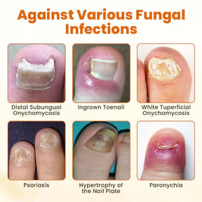 VenomNail Care – Deep Repair & Protection Formula