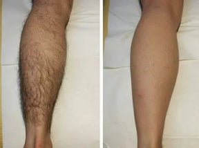 GlowSmooth – Moisturizing Hair Removal Spray
