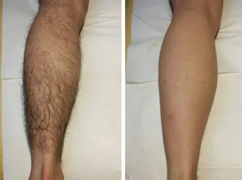 GlowSmooth – Moisturizing Hair Removal Spray