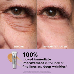 BlinkRevive – Instant Eye Tightening Solution