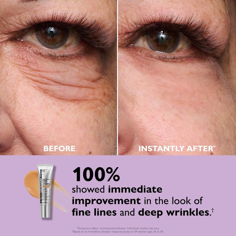 BlinkRevive – Instant Eye Tightening Solution