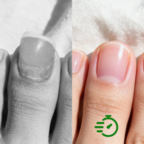 NailRevive Pro – Antifungal Repair Solution