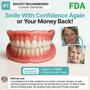 SmileLock – Premium Full Denture Solution