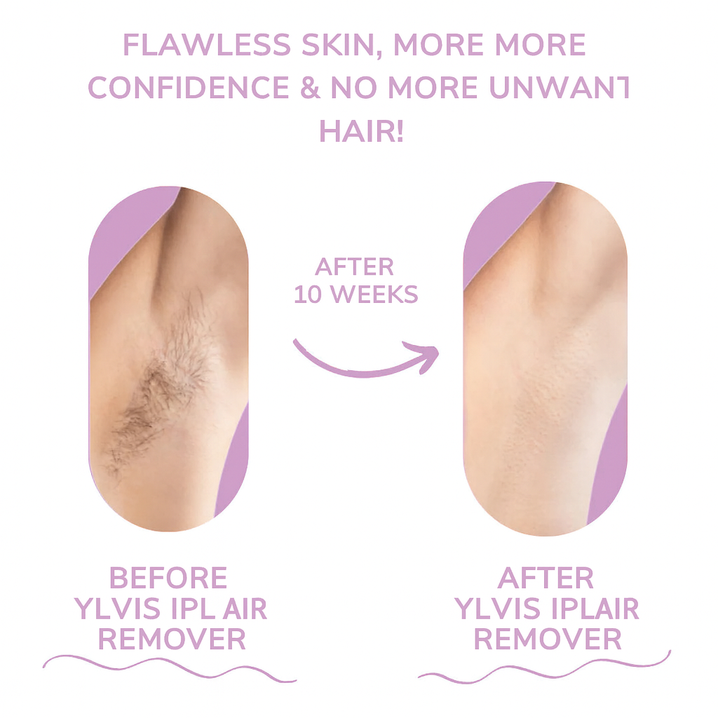 GlowEase - IPL Hair Remover for Effortless Smooth Skin