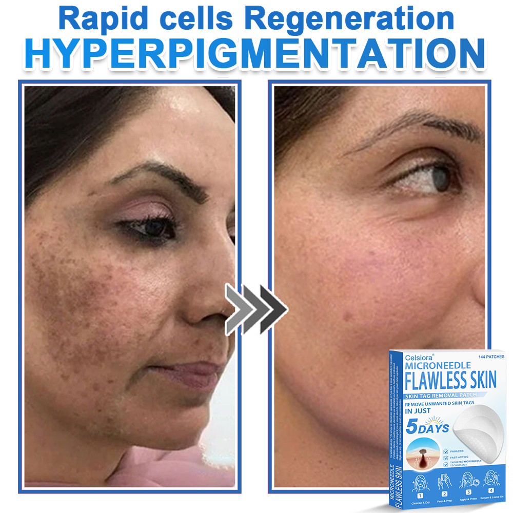 GlowSkin -  2-in-1 Microneedle & Hydrocolloid Star Patch