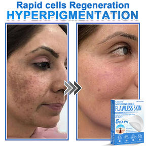 GlowSkin -  2-in-1 Microneedle & Hydrocolloid Star Patch