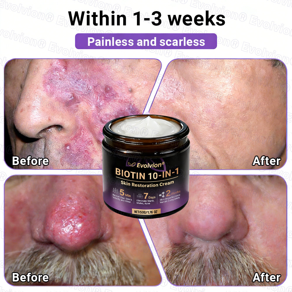 DermaVive – Biotin 10-in-1 Skin Restoration Cream