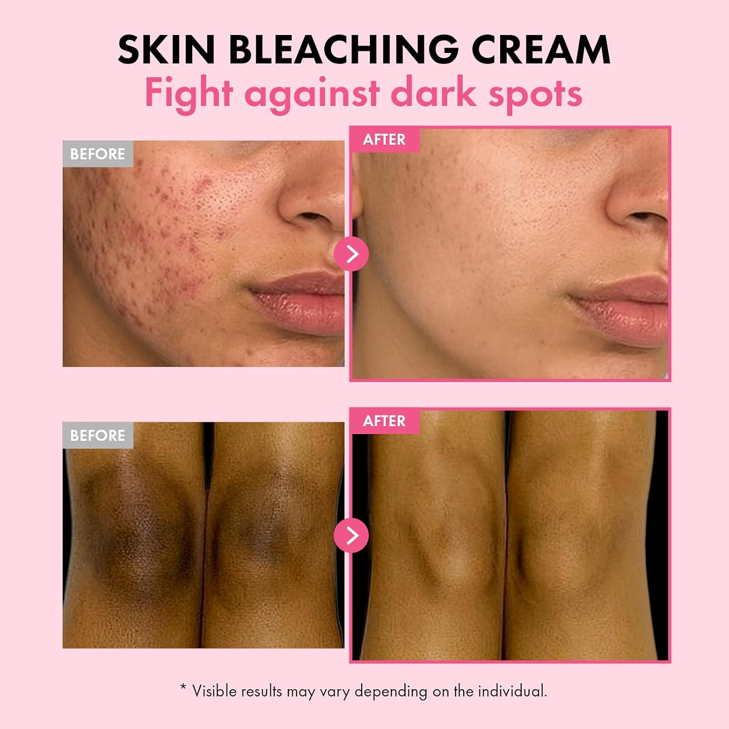 DermaGlow – Advanced Skin Renewing Treatment Cream