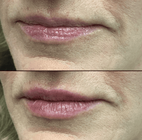 LumiLips – Long Lasting Moisture Lock Lipstick