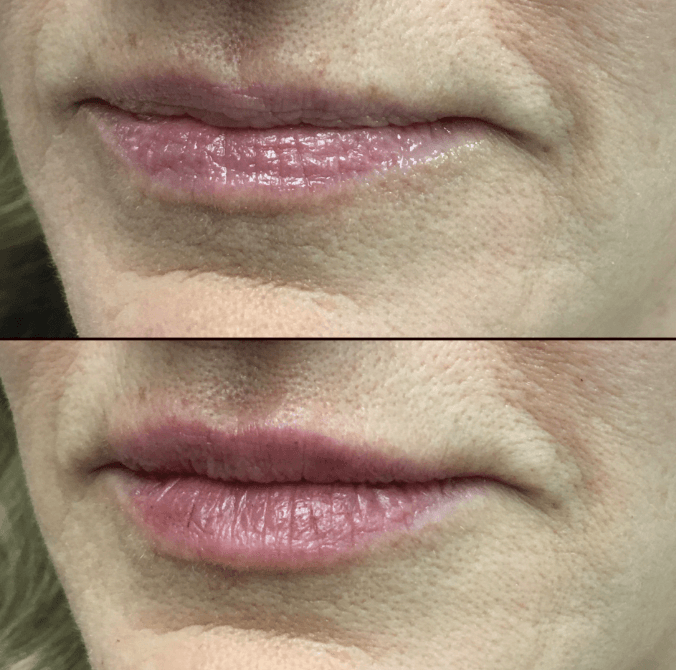 LumiLips – Long Lasting Moisture Lock Lipstick