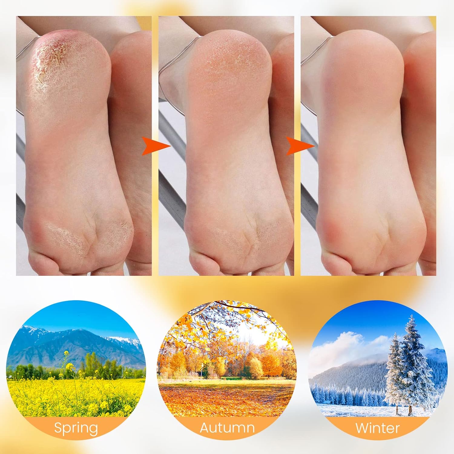 VelvetHeel Socks – Smooth Skin Foot Care