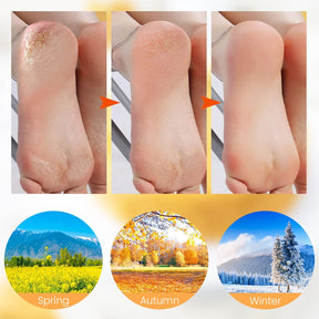 VelvetHeel Socks – Smooth Skin Foot Care