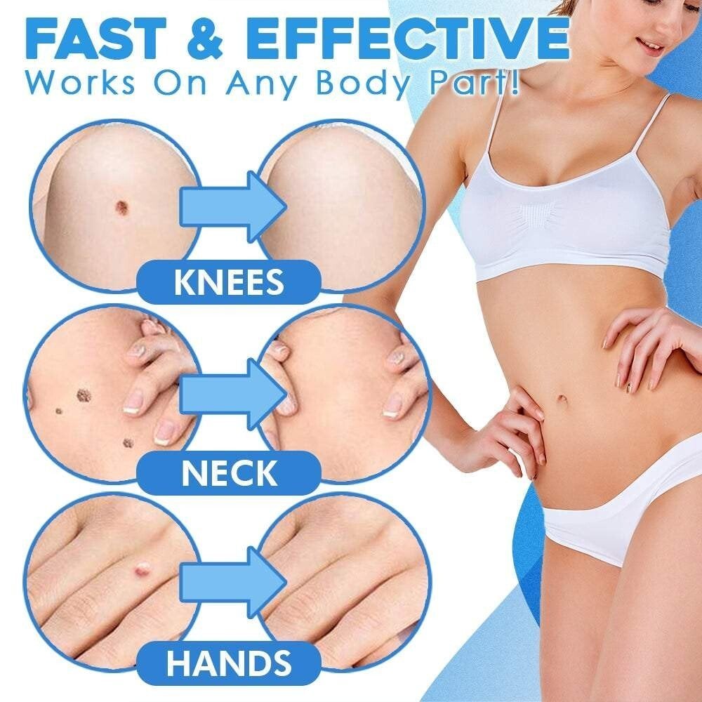 TagGone - Quick & Safe Skin Tag Remover