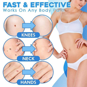TagGone - Quick & Safe Skin Tag Remover