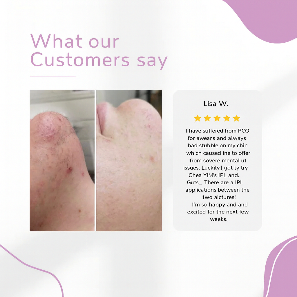 GlowEase - IPL Hair Remover for Effortless Smooth Skin