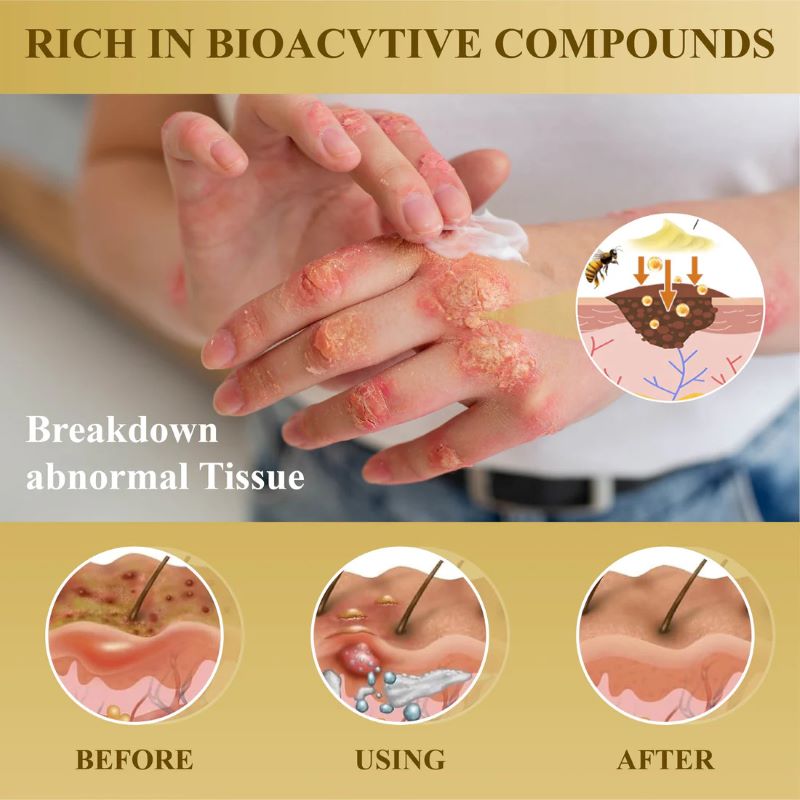 DermaVenom – Advanced Skin Repair Cream