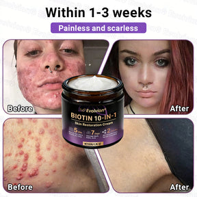 DermaVive – Biotin 10-in-1 Skin Restoration Cream