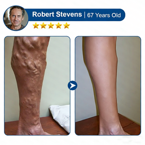 LegEase – Comfortable Vein Care Patch System