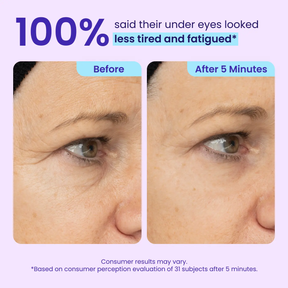 LumeGlow – Refreshing Rapid Reduction Eye Serum
