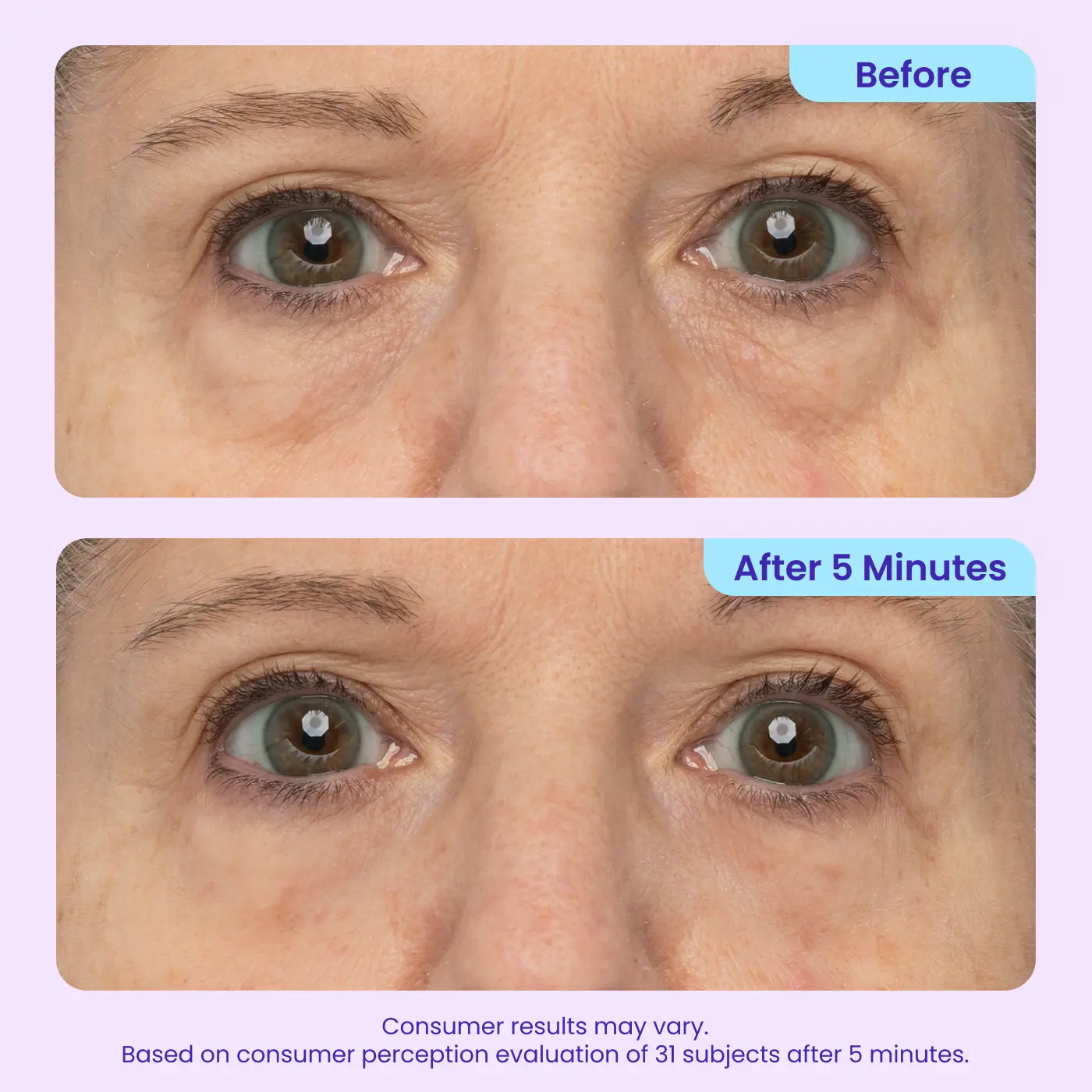 LumeGlow – Refreshing Rapid Reduction Eye Serum