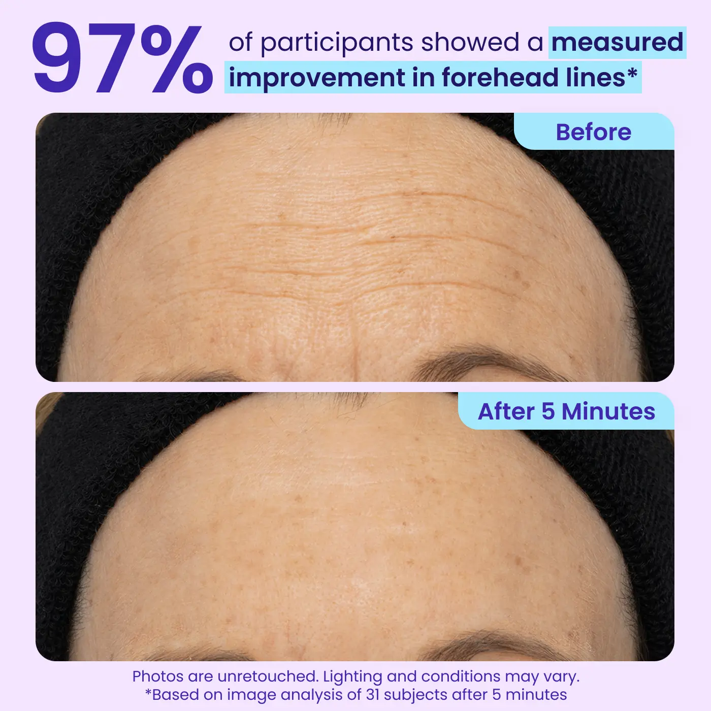 LumeGlow – Refreshing Rapid Reduction Eye Serum
