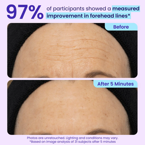 LumeGlow – Refreshing Rapid Reduction Eye Serum