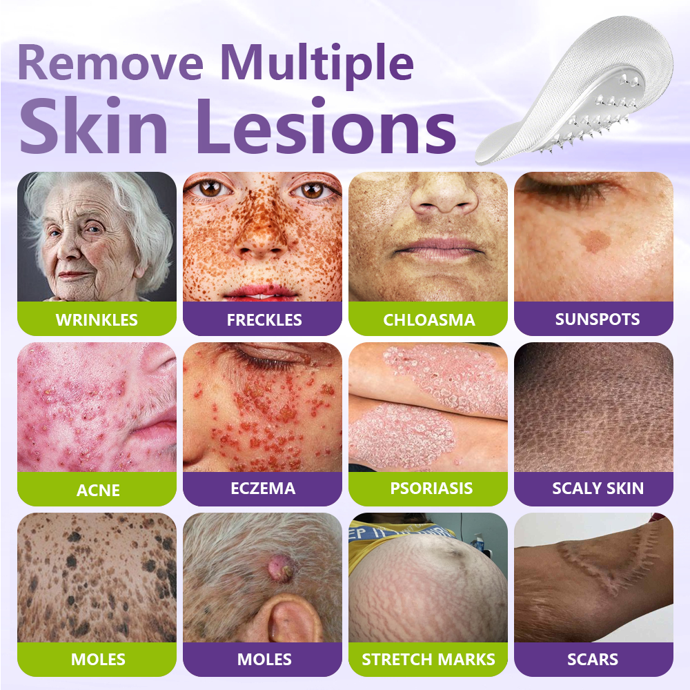 ClearDerma – Microneedle Skin Tag Removal Patch