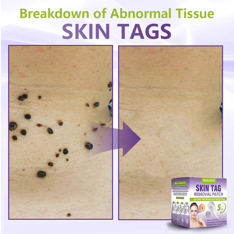 ClearDerma – Microneedle Skin Tag Removal Patch