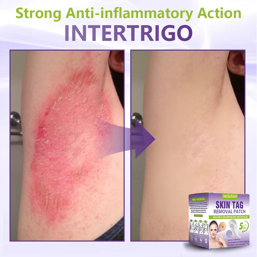 ClearDerma – Microneedle Skin Tag Removal Patch