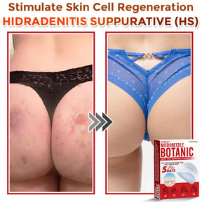 Natrvor –2-in-1  Microneedle Botanical Skin Renewal Patch