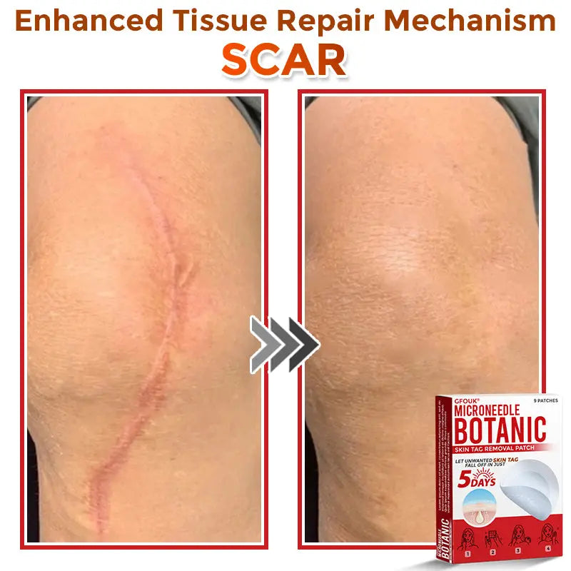 Natrvor –2-in-1  Microneedle Botanical Skin Renewal Patch