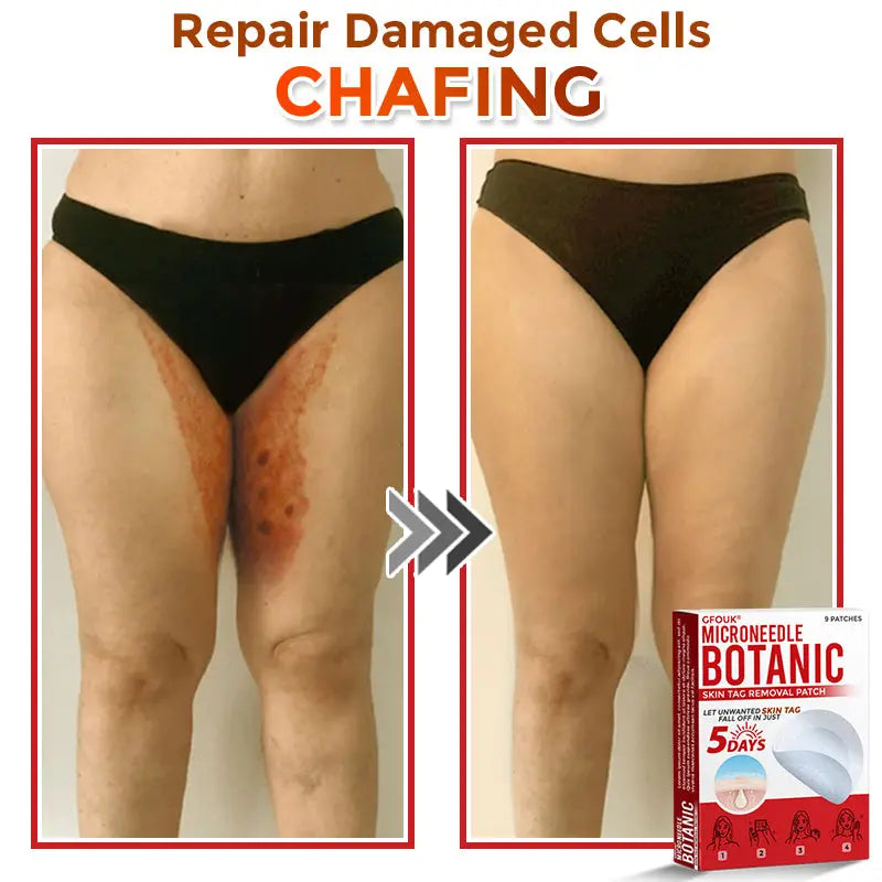 Natrvor –2-in-1  Microneedle Botanical Skin Renewal Patch