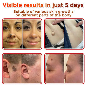 Natrvor –2-in-1  Microneedle Botanical Skin Renewal Patch
