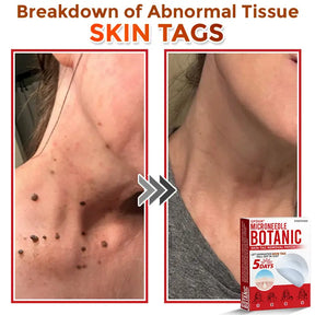 Natrvor –2-in-1  Microneedle Botanical Skin Renewal Patch