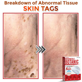 Natrvor –2-in-1  Microneedle Botanical Skin Renewal Patch