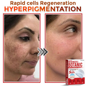 Natrvor –2-in-1  Microneedle Botanical Skin Renewal Patch