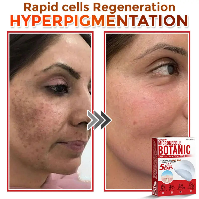 Natrvor –2-in-1  Microneedle Botanical Skin Renewal Patch