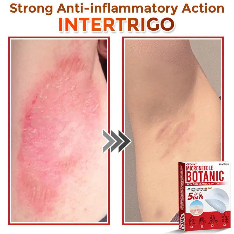 Natrvor –2-in-1  Microneedle Botanical Skin Renewal Patch