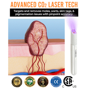 CleanBeam – Multi Function CO₂ Laser Eraser Pen Tool